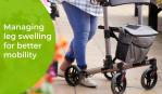 Things to Consider: Vascular Conditions and Managing Leg Swelling for Improved Mobility