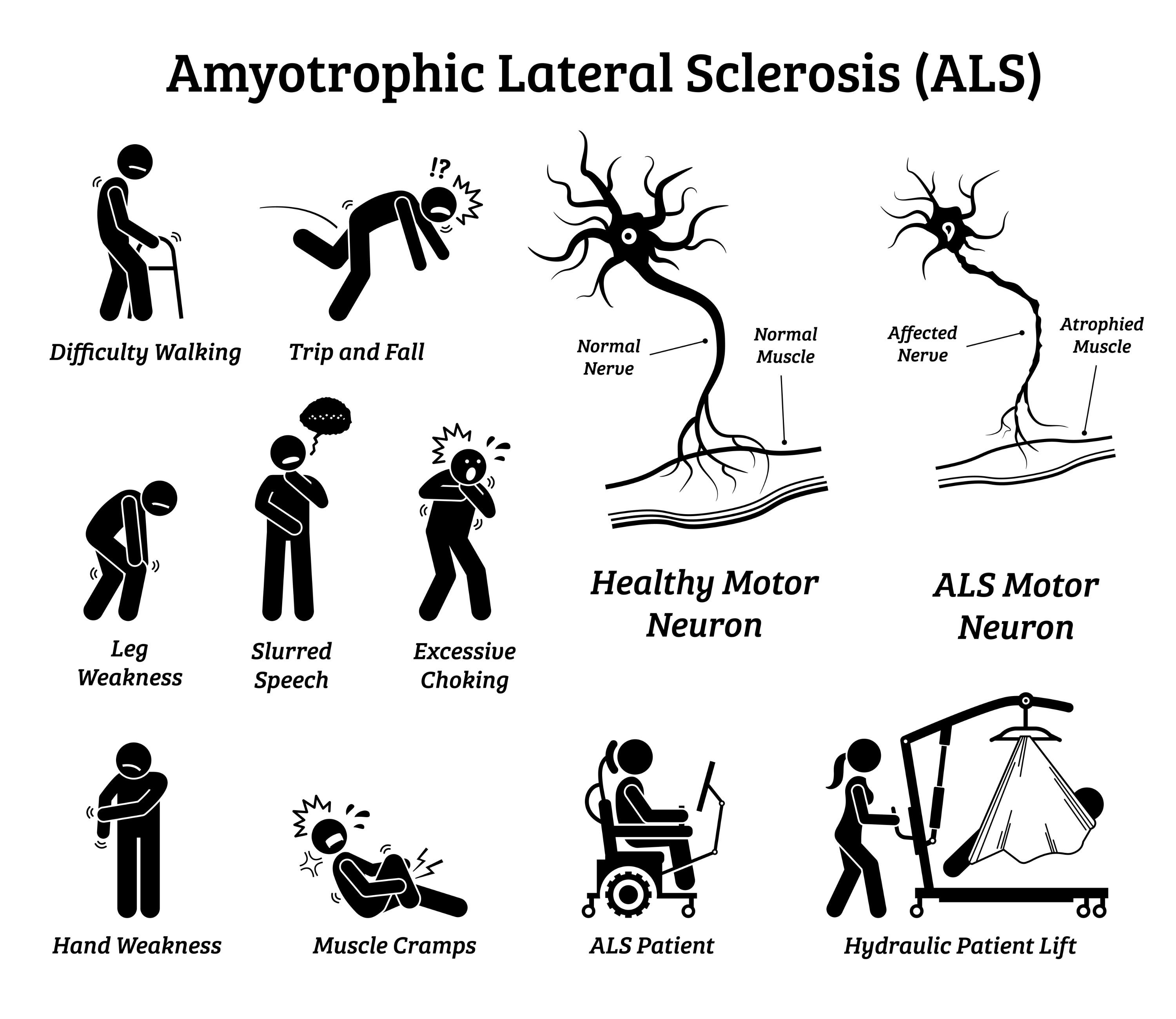 ALS challenges